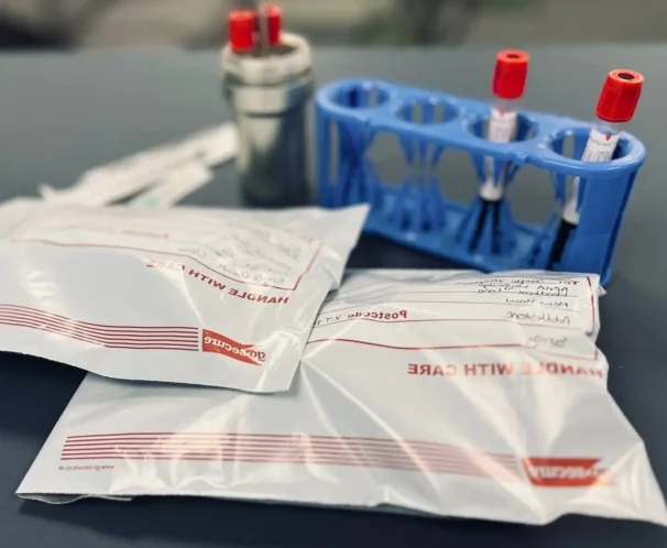 A blood sample collection kit containing vacutainer tubes and needles alongside biohazard specimen bags, prepared for equine testing.

What Are Horse Coggins Test? Essential Guide to Equine Infectious Anemia (EIA)